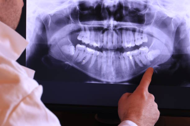 Best Emergency Denture Repair in Winsted, CT
